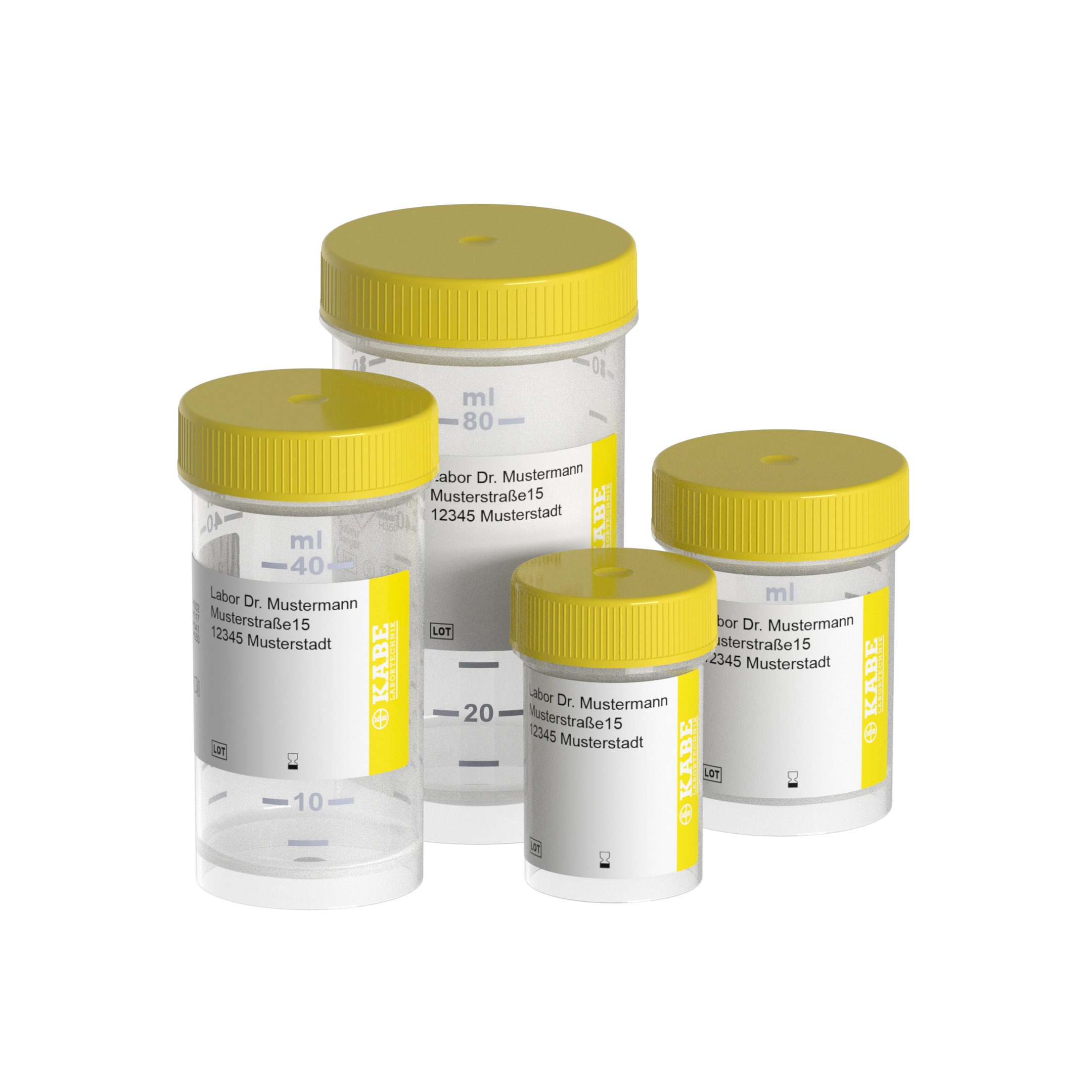 Probengefäße 20-100 ml mit Formalin und individuellem Etikett